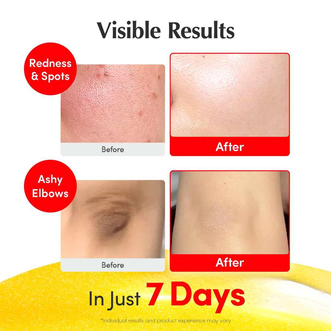 [EQQUALBERRY]  Glow Filter Vitamin Illuminating Serum 30ml