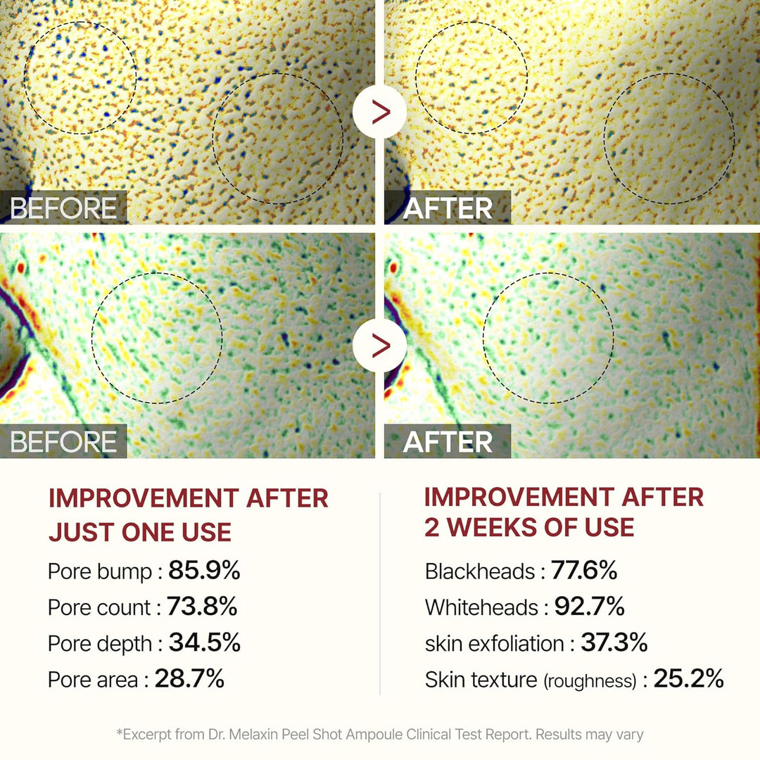 [Dr.Melaxin]  Peel Shot Glow White Rice Peeling Ampoule 80ml