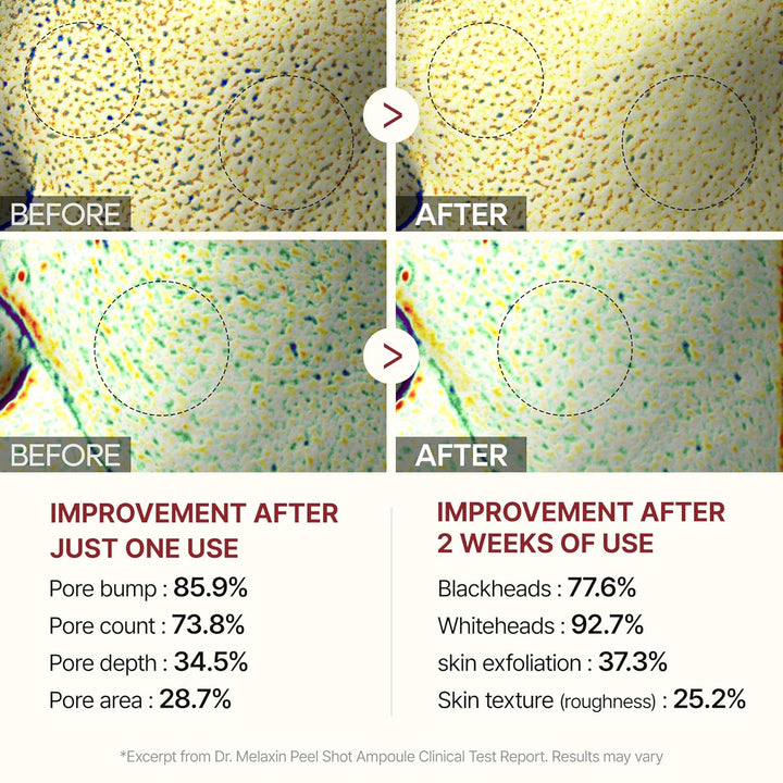 [Dr.Melaxin]  Peel Shot Glow Black Rice Peeling Ampoule 80ml